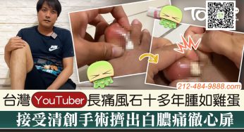 【痛風陷阱🤮】長痛風石十多年腫如雞蛋🥚18歲少年慘患痛風坐👨‍🦽輪椅